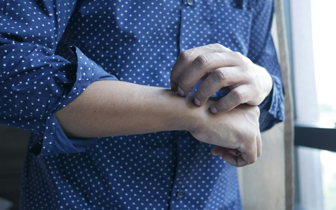 Why Your Autoimmune Symptoms Get Worse After Antifungal Treatment (And What to Do About It)