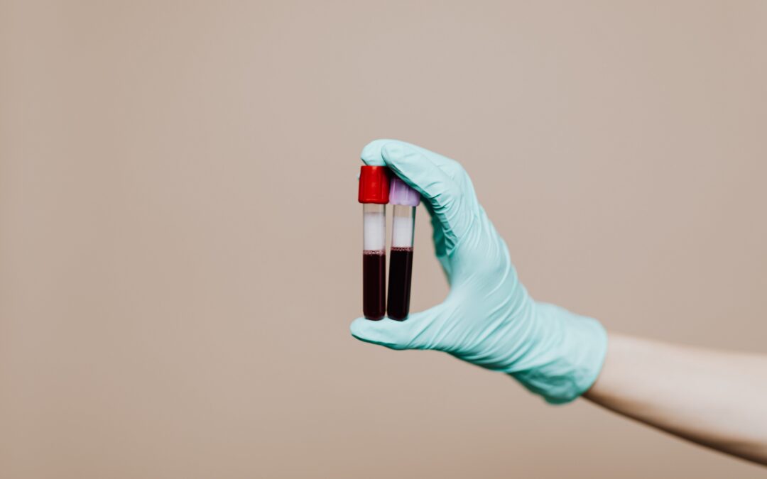Medical Literature Confirms, Long COVID *Is* Autoimmune Disease: Why Testing Cannot Wait